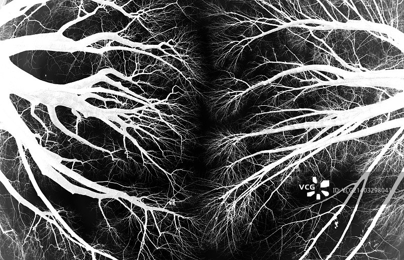 大脑树图片素材