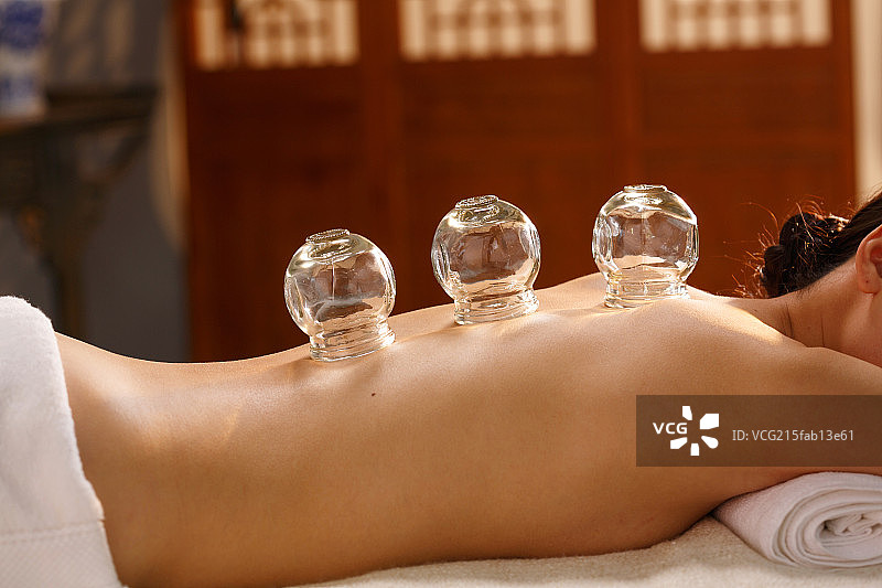 中医拔罐图片素材