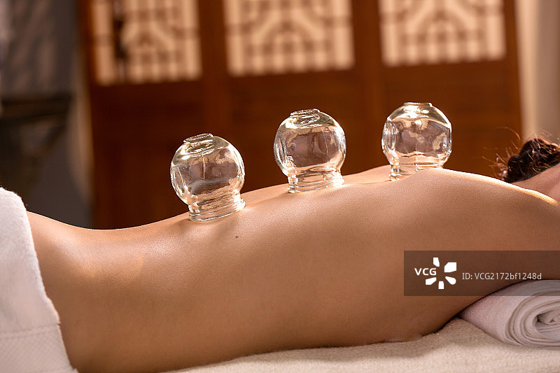 中医拔罐图片素材