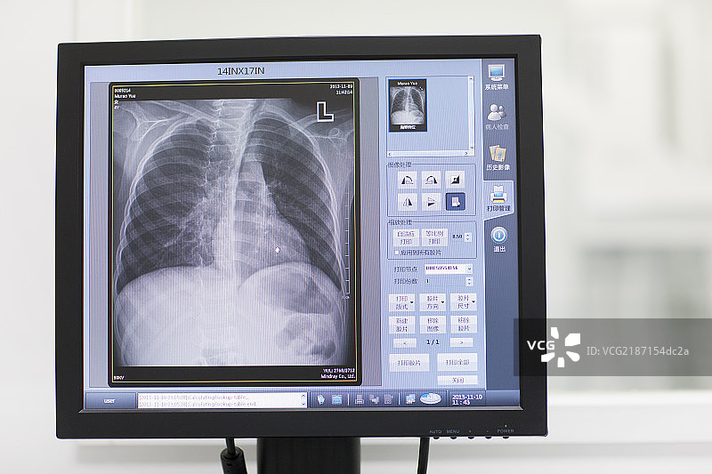 医院电脑屏幕图片素材