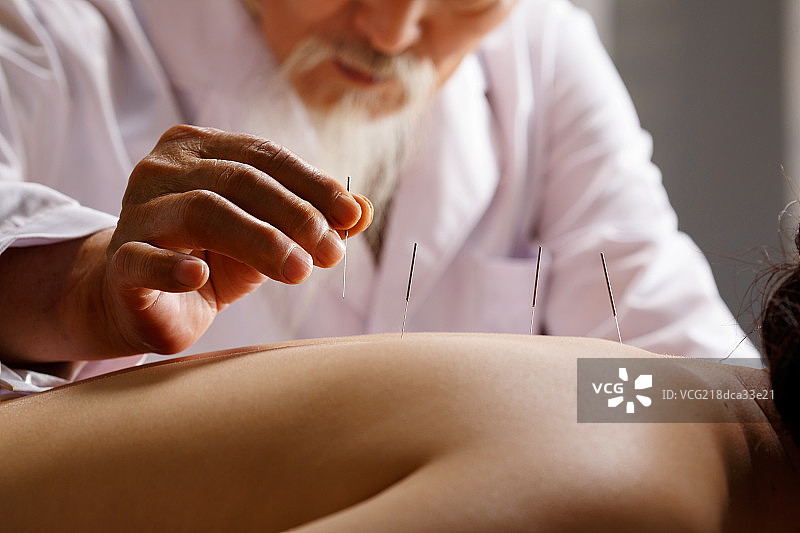 中医针灸图片素材