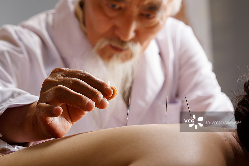 中医针灸图片素材