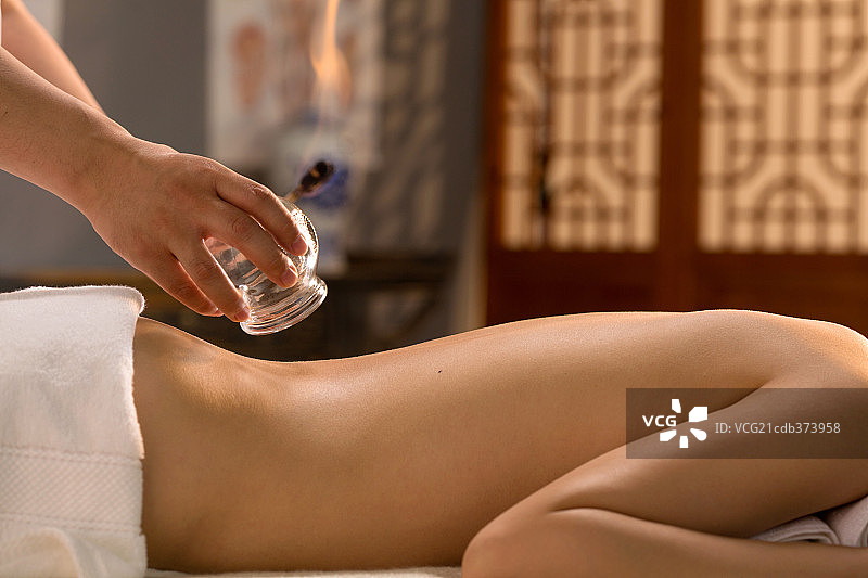 中医拔罐图片素材