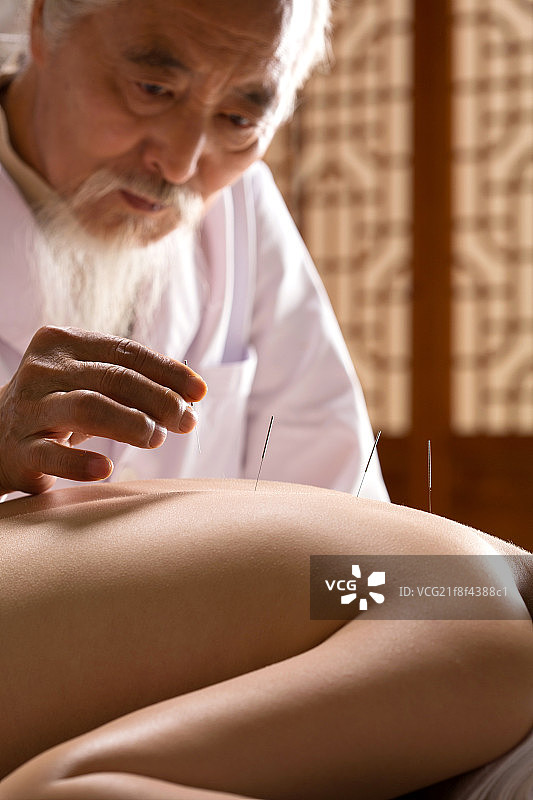 中医针灸图片素材