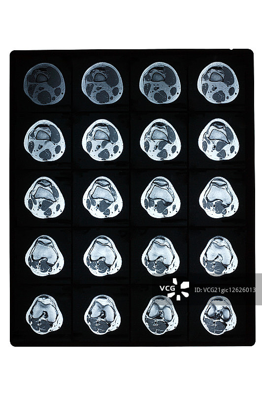 核磁共振扫描图片素材
