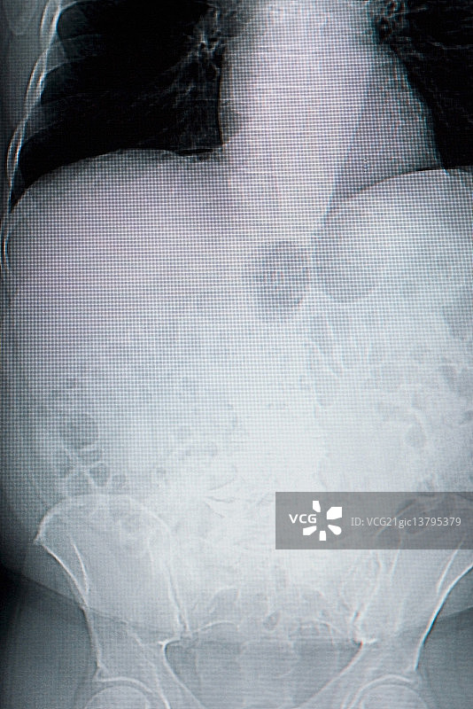 医疗放射线照片图片素材