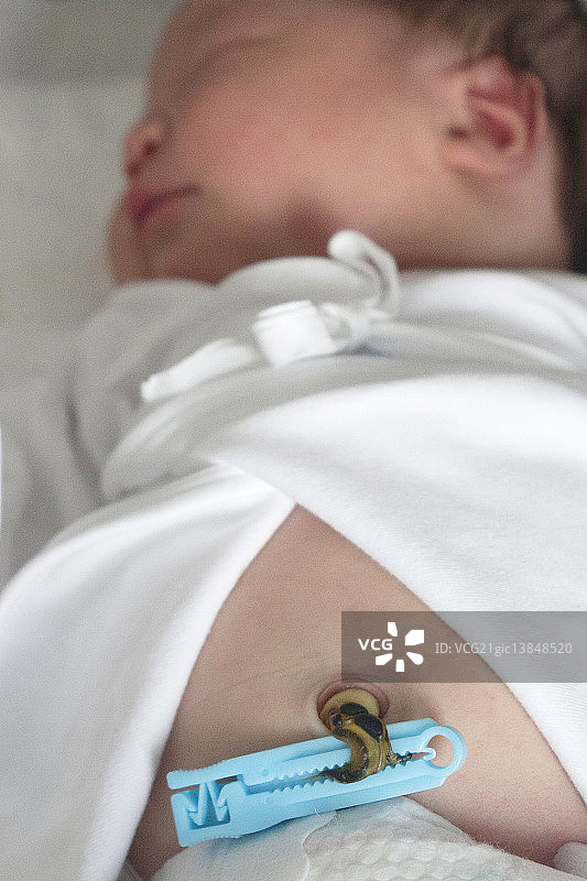 新生儿的肚脐图片素材