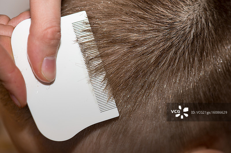 寻找孩子头上的虱子图片素材