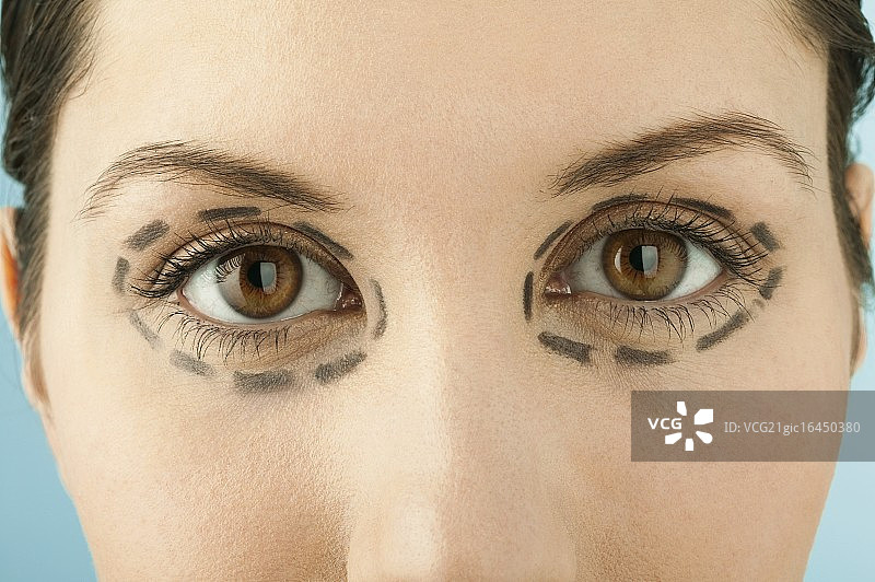 为整形手术做标记的眼睛图片素材