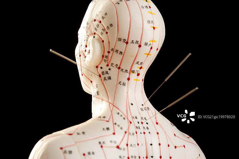 针灸穴位图片素材