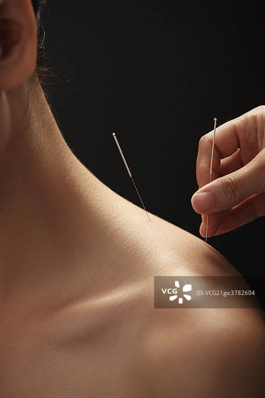 中医针灸图片素材