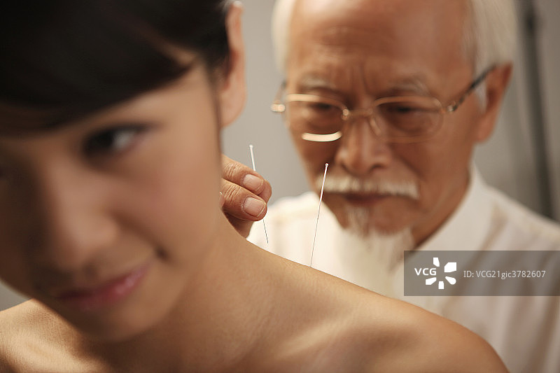 中医针灸图片素材