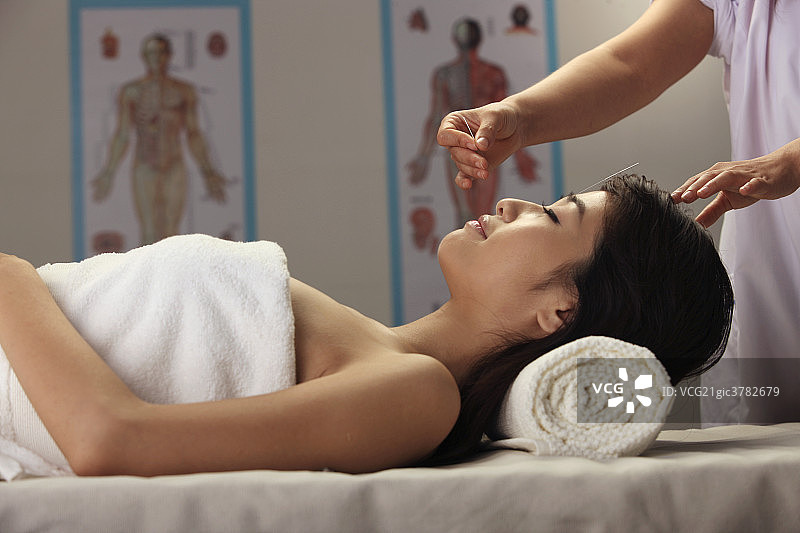 中医针灸图片素材