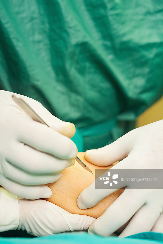 外科医生在手术室手持手术刀的特写图片素材