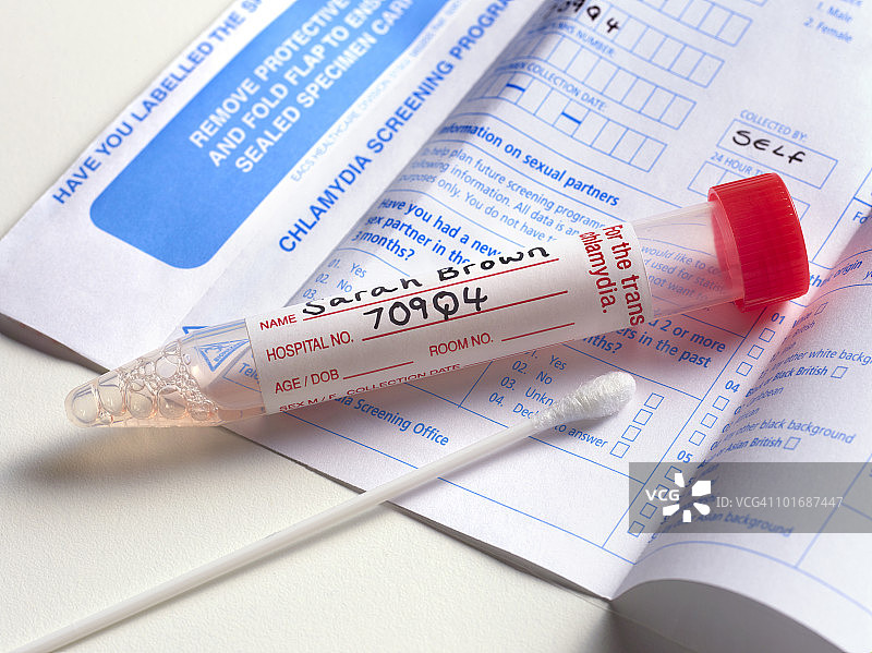 衣原体筛查涂片测试图片素材