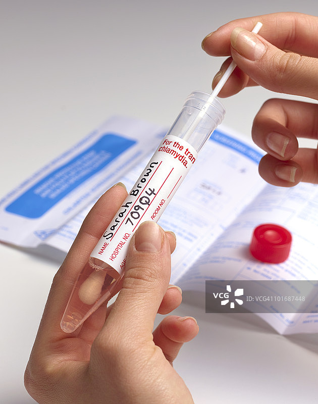 衣原体涂片检查图片素材