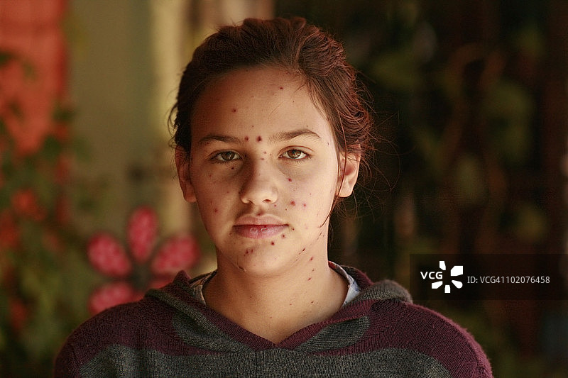 乌拉圭，长粉刺的女孩肖像图片素材