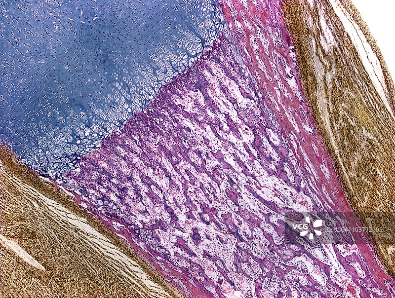 骨骼发育显微照片图片素材