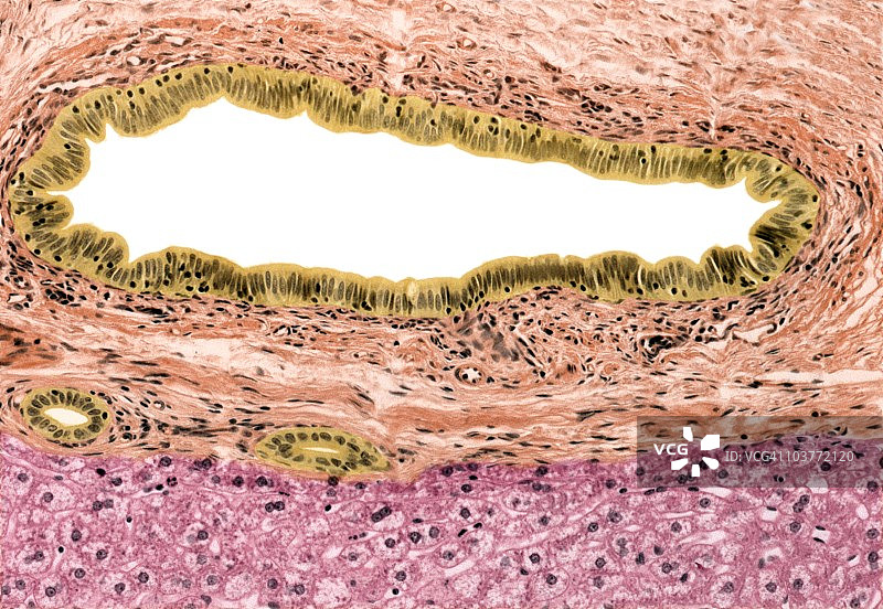 胆管显微照片图片素材