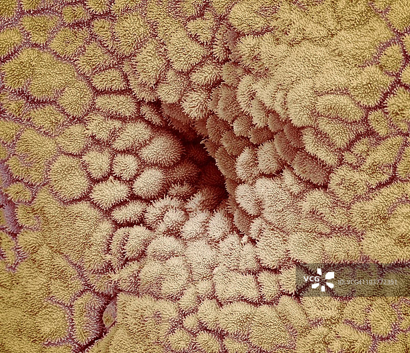 子宫内膜扫描电镜图图片素材