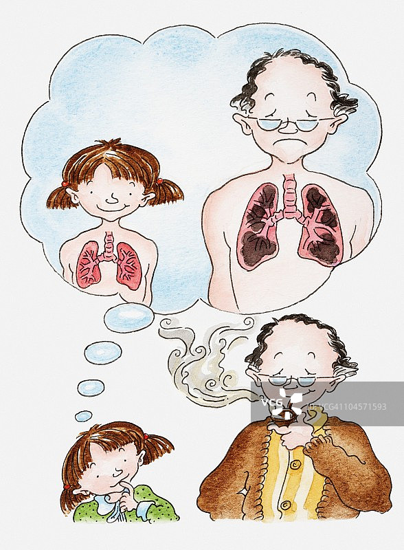 吸烟斗的男人旁边的女孩，气泡显示健康肺和吸烟者肺部的插画图片素材