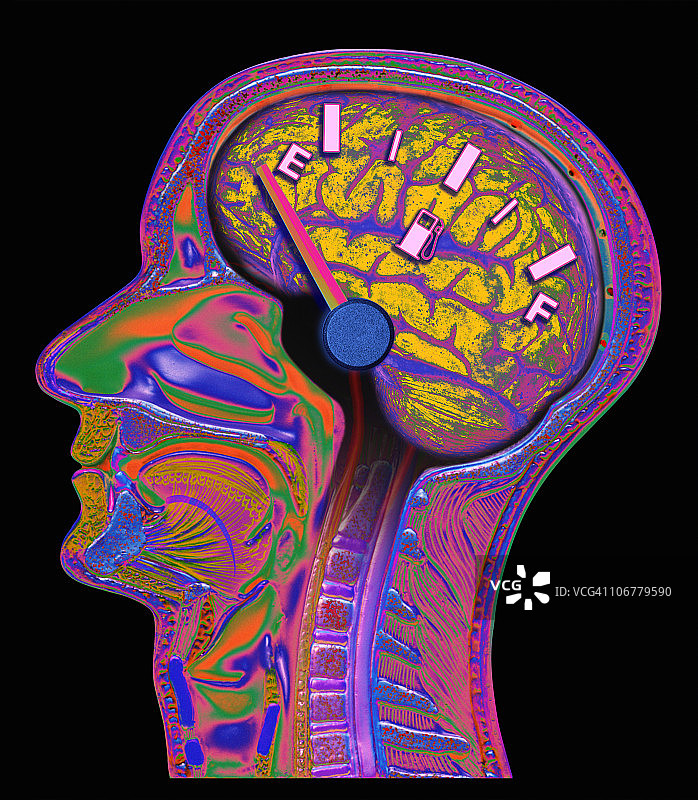 男性大脑横截面，油量表显示为空图片素材