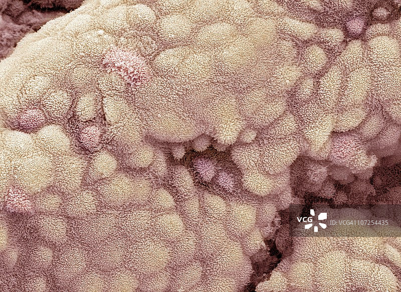 胆囊表面扫描电镜图图片素材