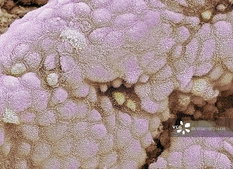 胆囊表面扫描电镜图图片素材