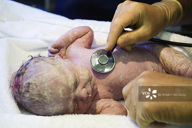 检查新生婴儿图片素材