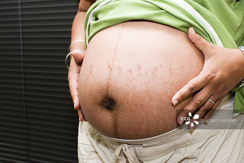 有妊娠纹的孕妇图片素材
