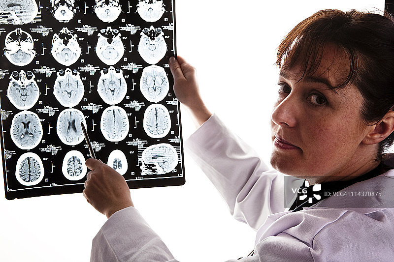 手持脑部扫描图的医生图片素材
