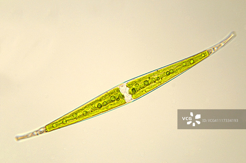 梭菌藻类显微照片图片素材