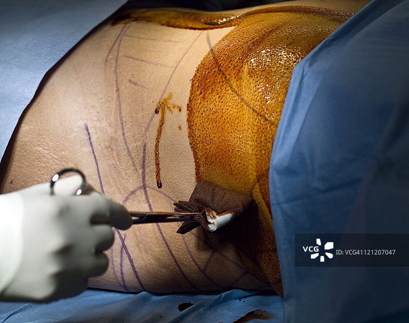 为病人消毒图片素材