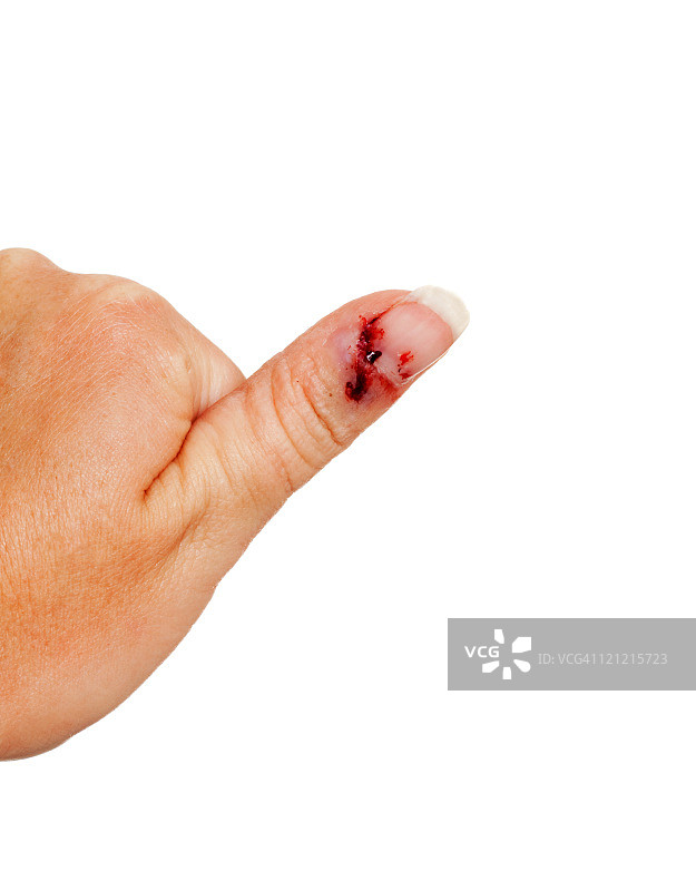 受伤流血的白人女性手部特写：拇指图片素材