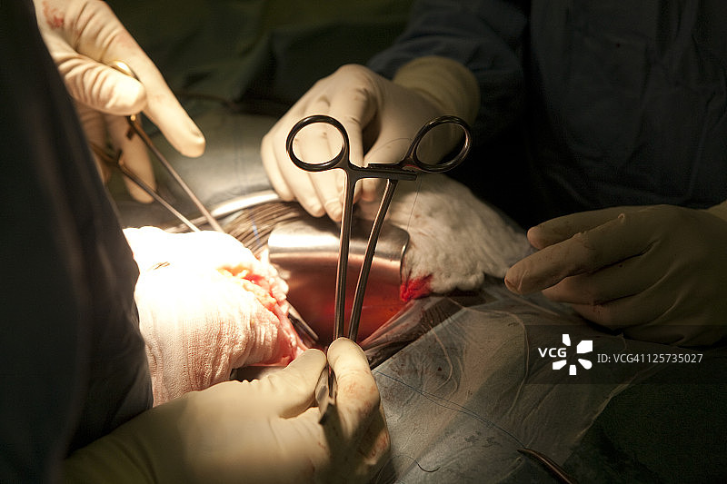 捐献者肾脏切除图片素材