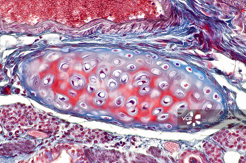 透明软骨，肺，(放大100倍)马森染色。支气管壁上的软骨板。显示软骨细胞、基质、腔隙和软骨膜图片素材