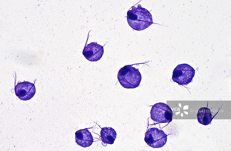 阴道毛滴虫：一种引起阴道炎的鞭毛原虫寄生虫（放大250倍），细胞核已染色。该单细胞有四条鞭毛和一个波状膜。常见症状包括严重的生殖器瘙痒和阴道分泌物。图片素材