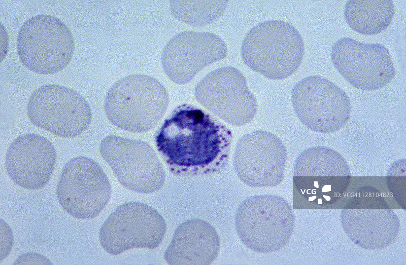 疟原虫在红细胞内，间日疟原虫，500倍图片素材