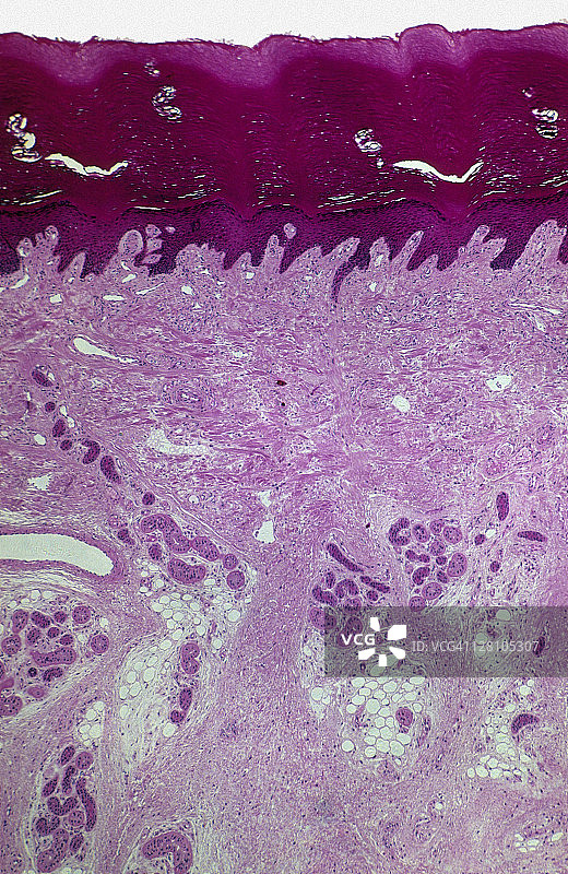 皮肤：表皮、真皮、皮下层，人体手掌厚皮，10倍放大，35毫米。显示：汗腺和导管、脂肪组织、血管图片素材