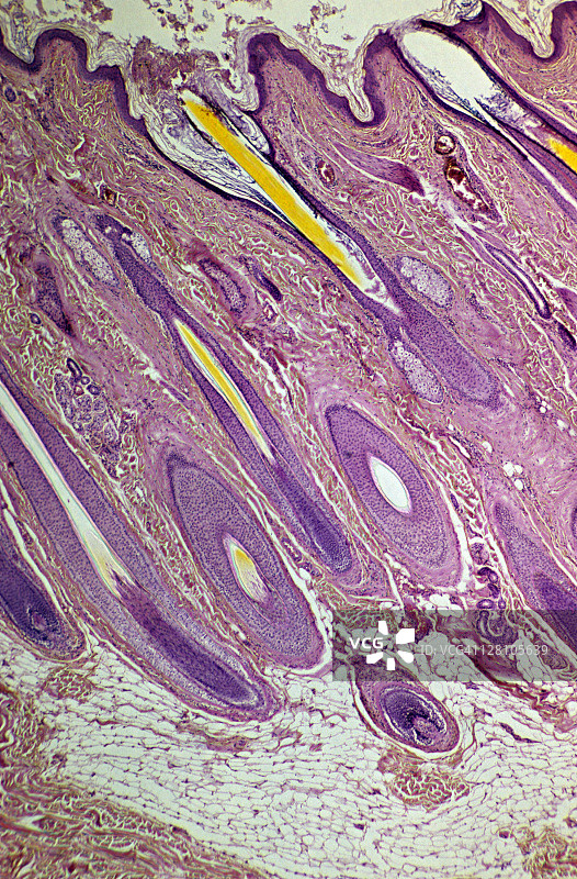 头皮毛囊特写：表皮、真皮、皮下脂肪组织、毛囊、毛干、汗腺、皮脂腺和立毛肌图片素材