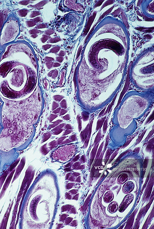 旋毛虫，50X, 35mm，旋毛虫，囊肿和蠕虫。蠕虫被包住在骨骼肌(猪肉)里。图片素材