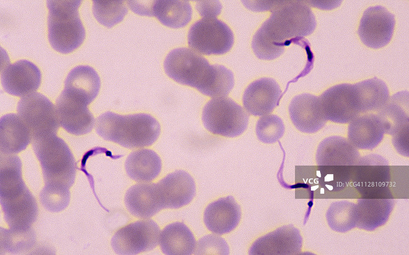 锥虫，恰加斯病病原体，血涂片图片素材