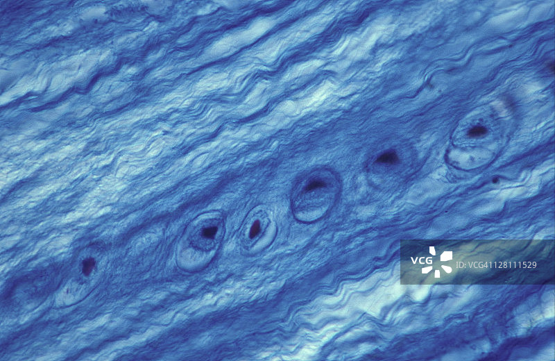椎间盘纤维软骨中的软骨细胞（250倍显微图）图片素材