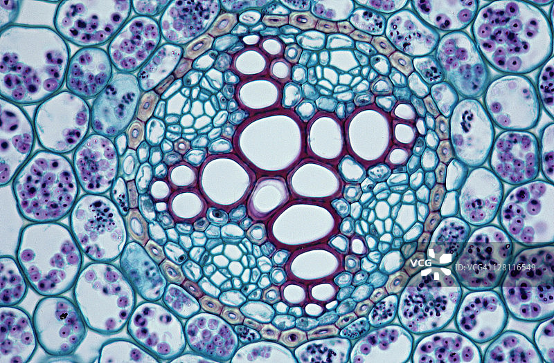 毛茛根横截面：内皮层、木质部、淀粉粒图片素材