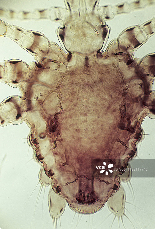 阴虱的昆虫气管系统，25倍放大，显示精细的分支气管将氧气输送到身体细胞图片素材