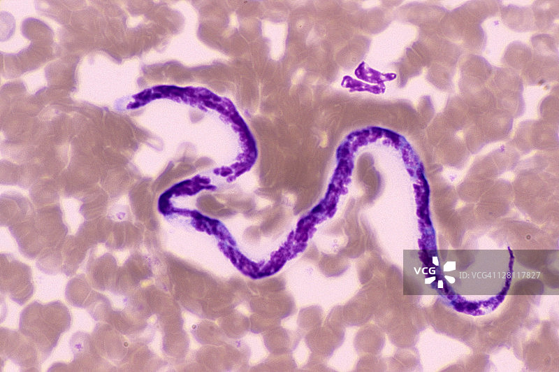 犬心丝虫。恶丝虫。血液涂片，250X图片素材