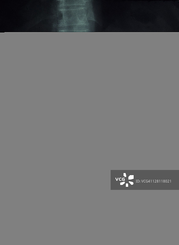 下消化道（胃肠道）X光片：显示大肠和小肠，采用钡剂技术图片素材