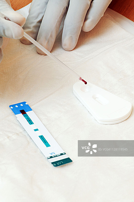 HIV检测，南非豪登省约翰内斯堡图片素材