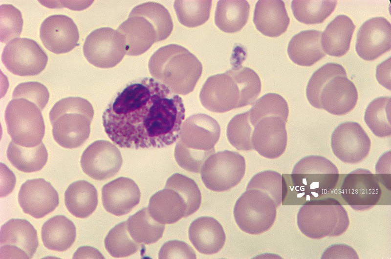 嗜酸性粒细胞（白细胞）和红细胞，颗粒状白细胞双叶核.500X图片素材
