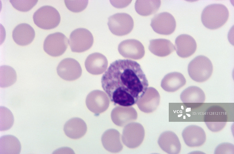嗜酸性粒细胞和红细胞的人血涂片，1000倍图片素材